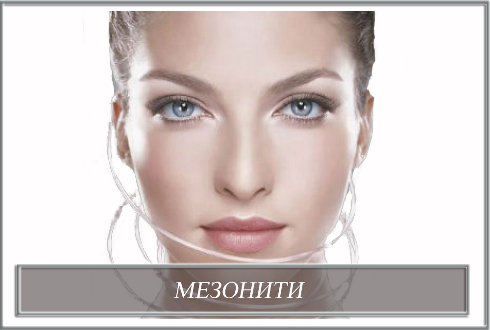 Мезонити